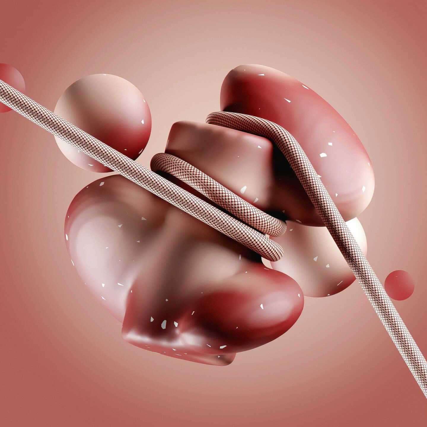 ISCHEMIA Trial, image 1 of 1
