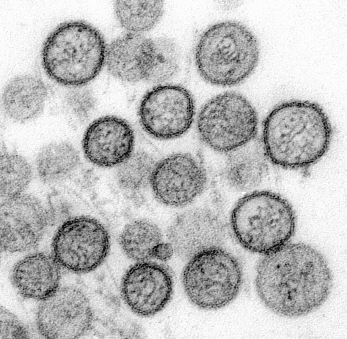 Fleming, On the Antibacterial Action of Cultures of a Penicillium, image 1 of 1