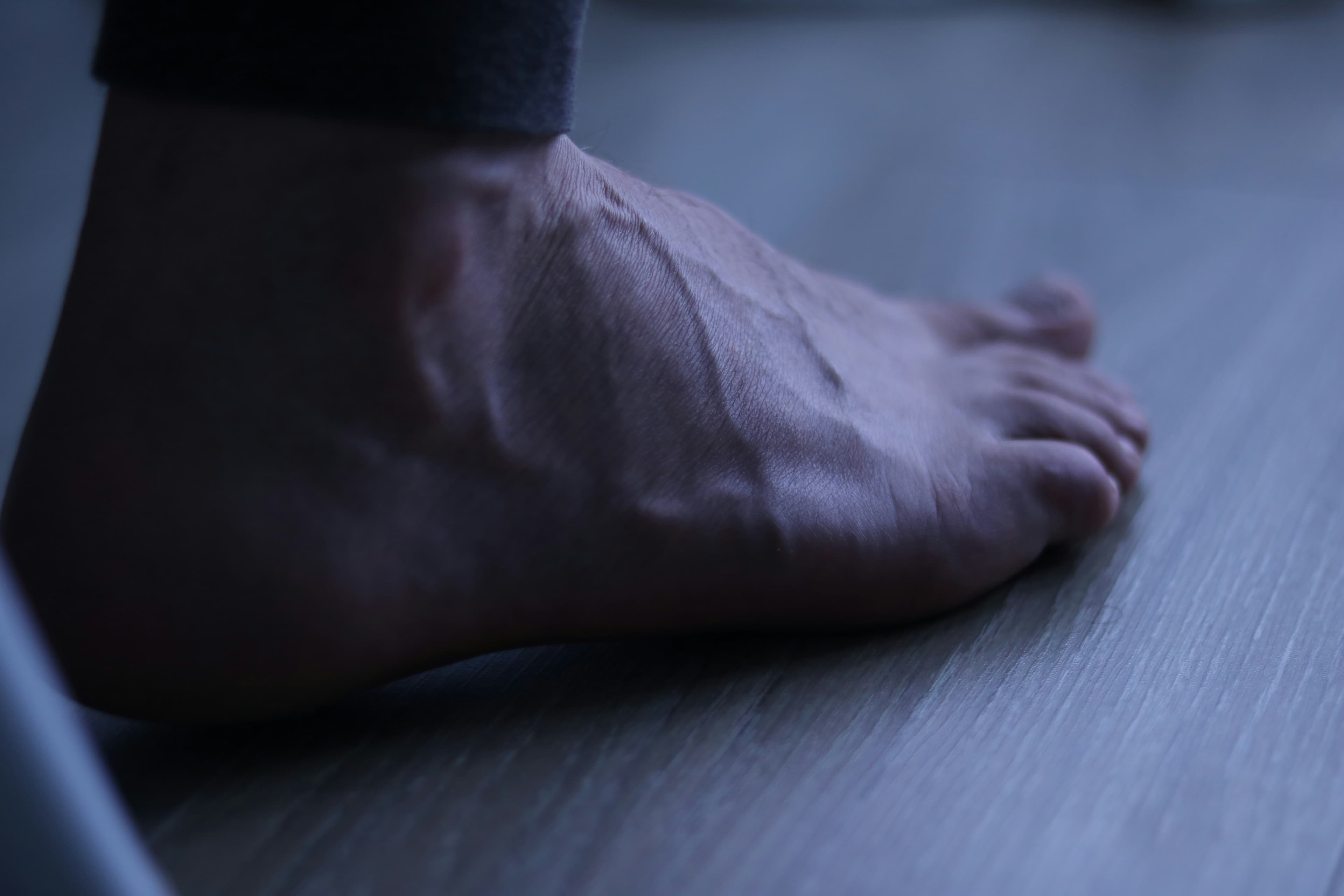 Heavy-load eccentric calf muscle training for the treatment of chronic Achilles tendinosis, image 1 of 1