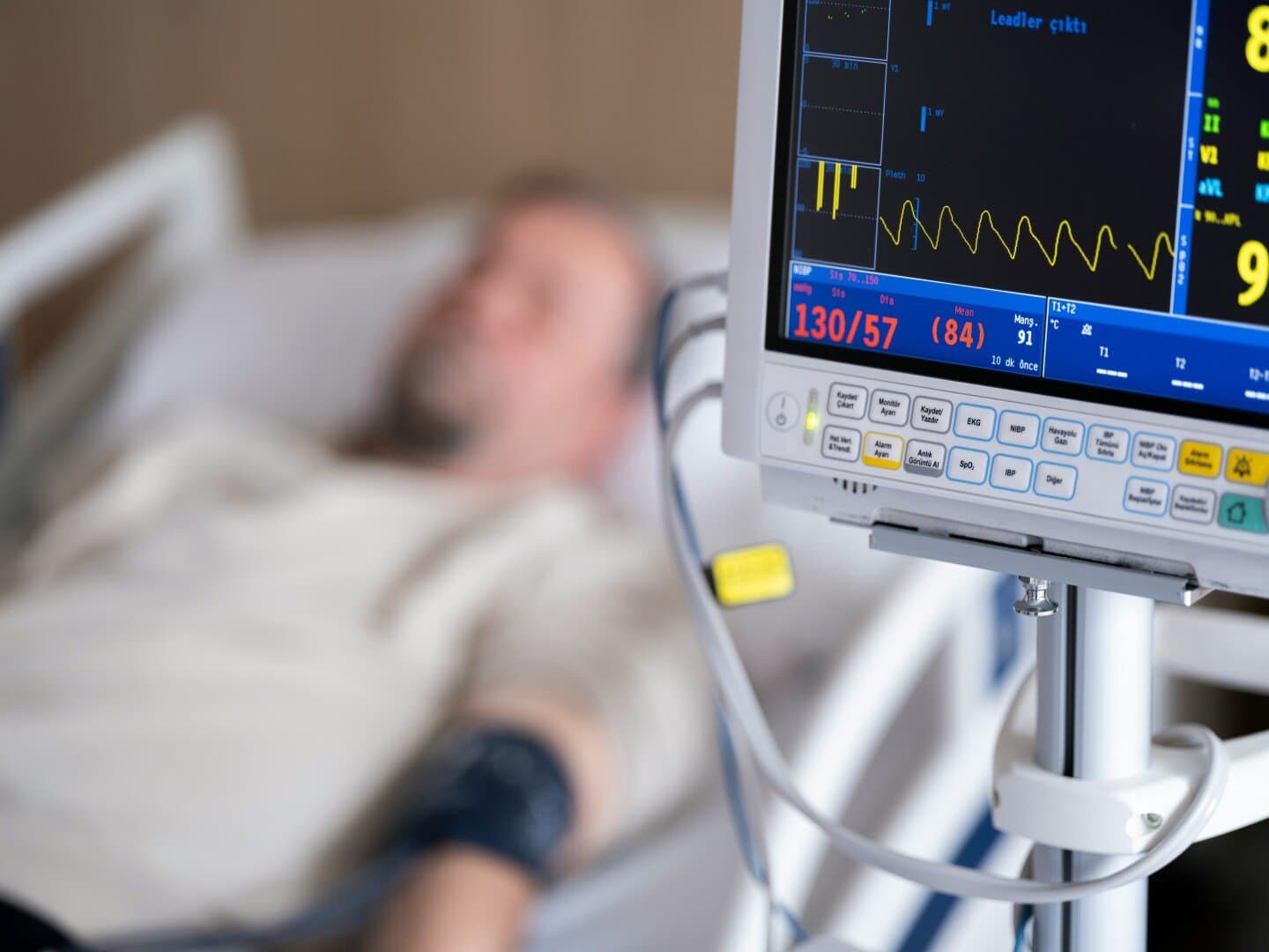 PARADIGM-HF Trial, image 1 of 1