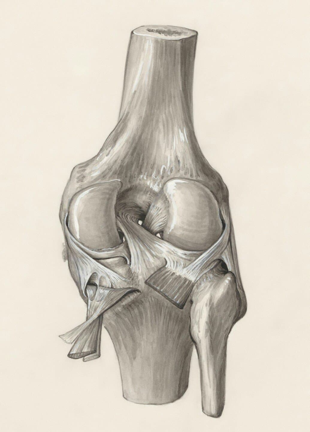 Clinical Outcomes, Structure, and Function Improve With Both Heavy and Moderate Loads in the Treatment of Patellar Tendinopathy: A Randomized Clinical Trial, image 1 of 1