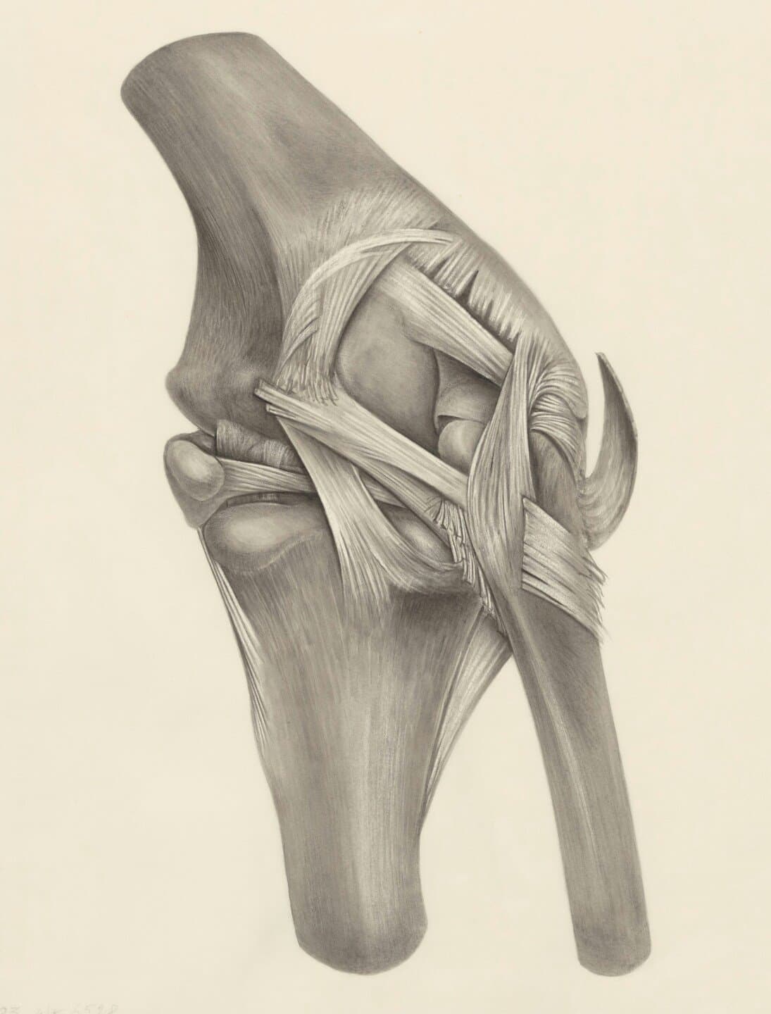 Corticosteroid injections, eccentric decline squat training and heavy slow resistance training in patellar tendinopathy, image 1 of 1