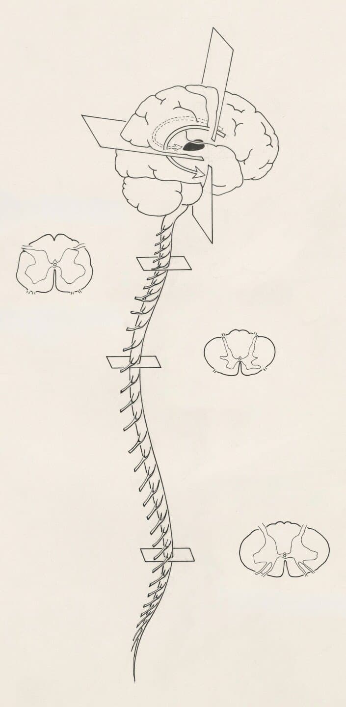 Dorsal and Ventral Streams in the Visual System, image 1 of 1