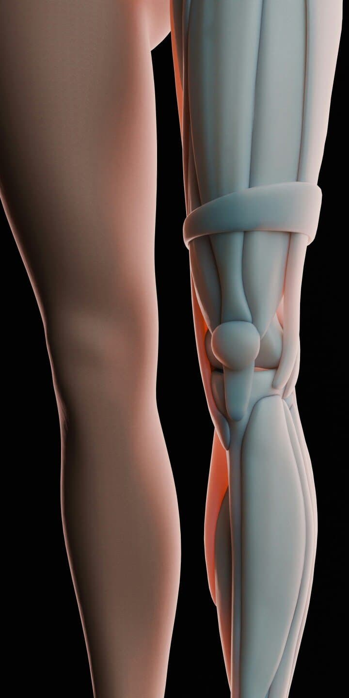 ACL Return to Sport Criteria, image 1 of 1